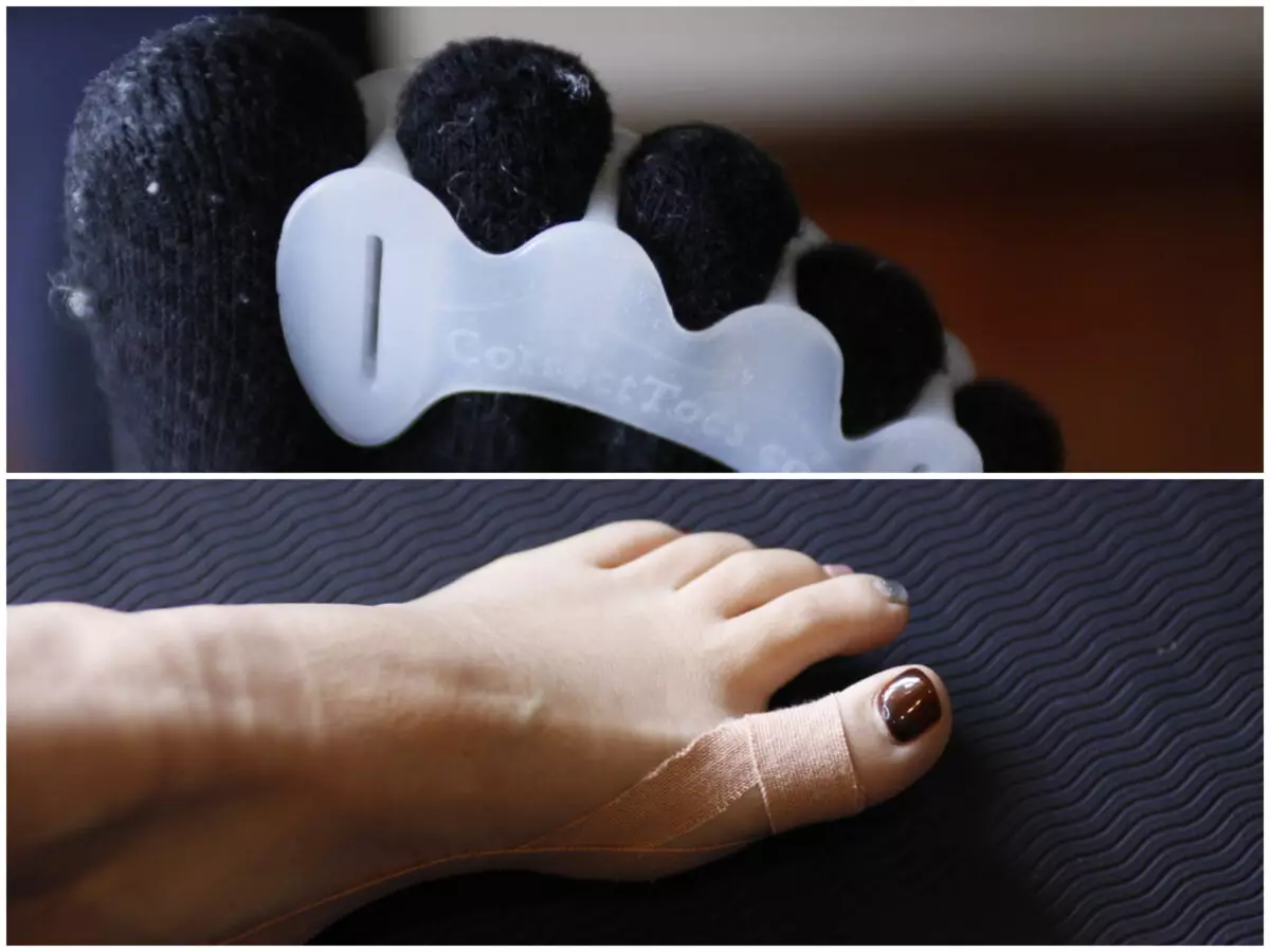 【簡単】外反母趾対策-テーピング&足指スペーサーの活用方法